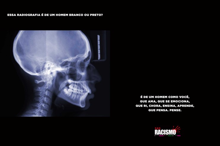 anuncios-racismo-radiografia